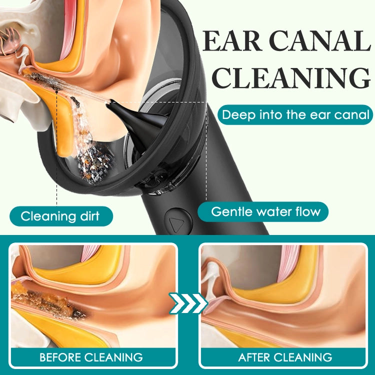 Automatic Ear Cleaner — Gentle Water Pulse Cleaning for Everyday Ear Care