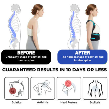 Snuggy™ Adjustable Posture Corrector Belt