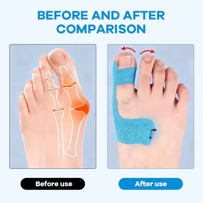 Pre-Cut Bunion Corrector Kinesiology Tape